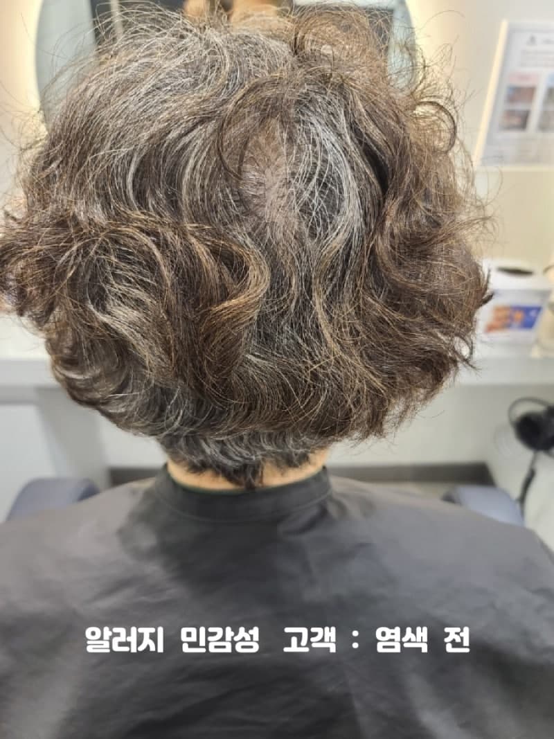 민감성·알러지 두피 — 염색해도 될까? 시술 사례 3