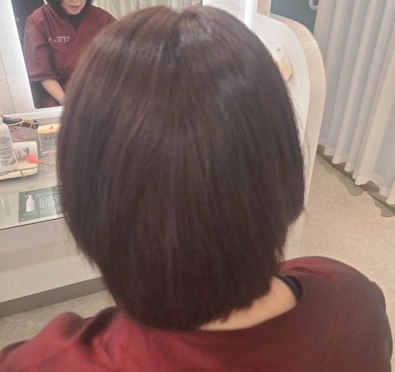 염색 후 두피 케어 — 헤드스파가 필요한 이유 시술 사례 1